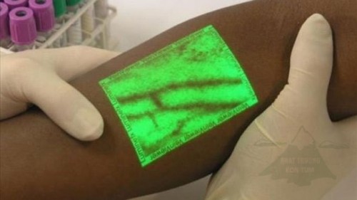Cơ chế hoạt động của Vein Viewer đó là: thiết bị này sẽ chiếu ánh sáng hồng ngoại lên da, ánh sáng được các huyết sắc tố (hemoglobin) trên da hấp thụ và phản chiếu lại các mô xung quanh