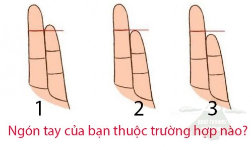 Ngón tay bạn thuộc trường hợp nào