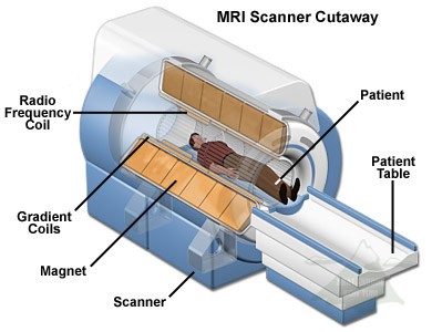 chụp mri 4