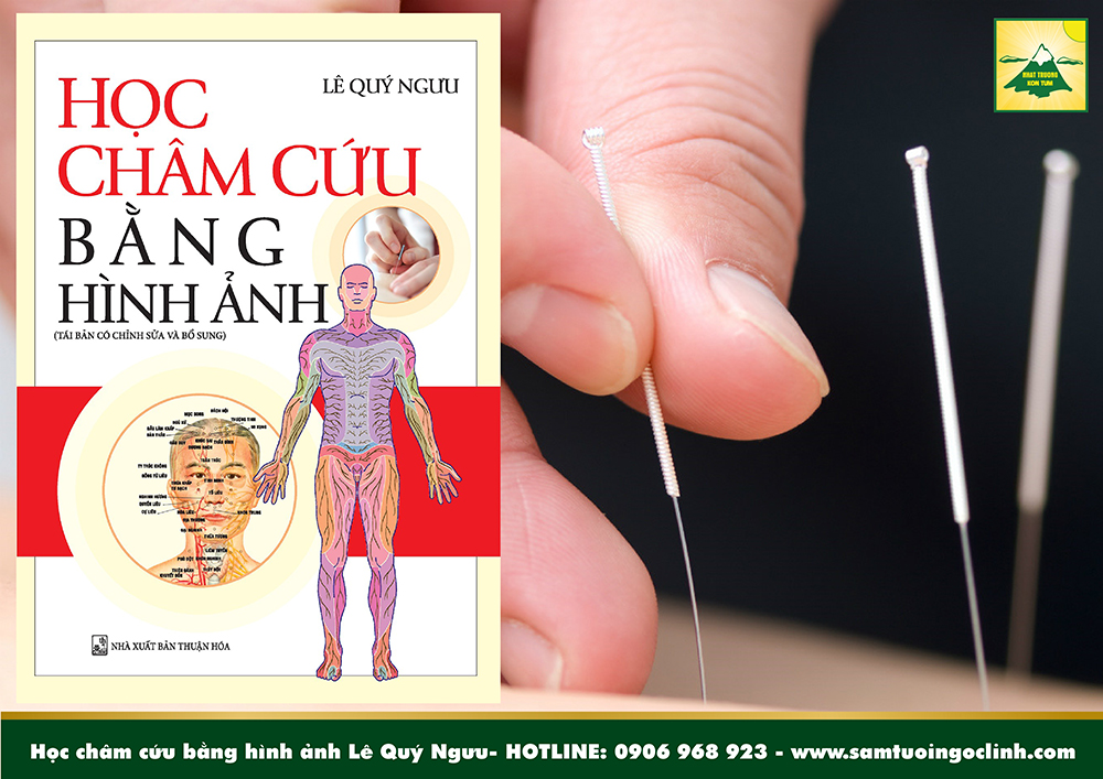 học châm cứu bằng hình ảnh lê quý ngưu (1)